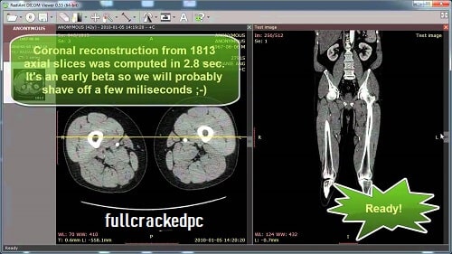 RadiAnt DICOM Viewer 2024.2.3 Crack With License Key [Latest]
